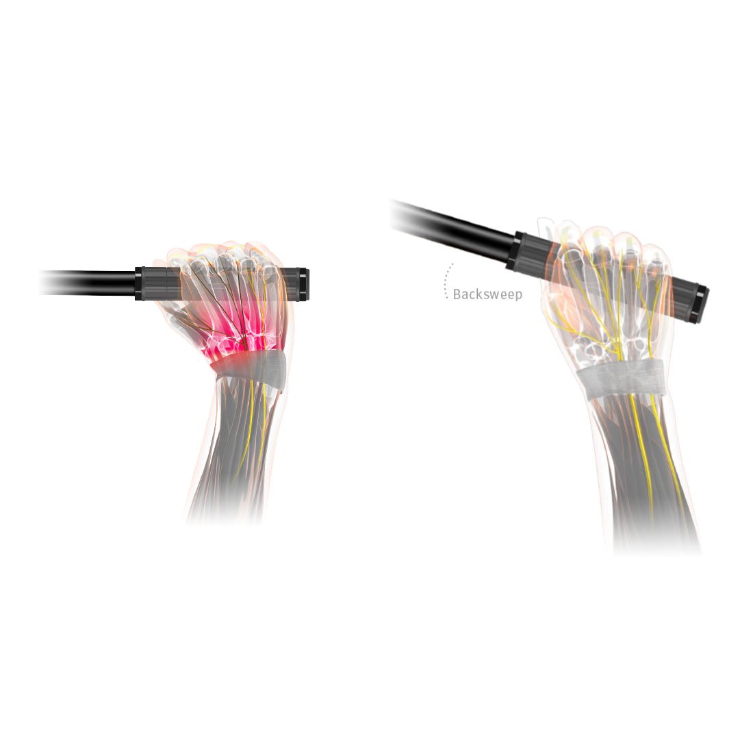 310 3.0 Lenker - Schwarz